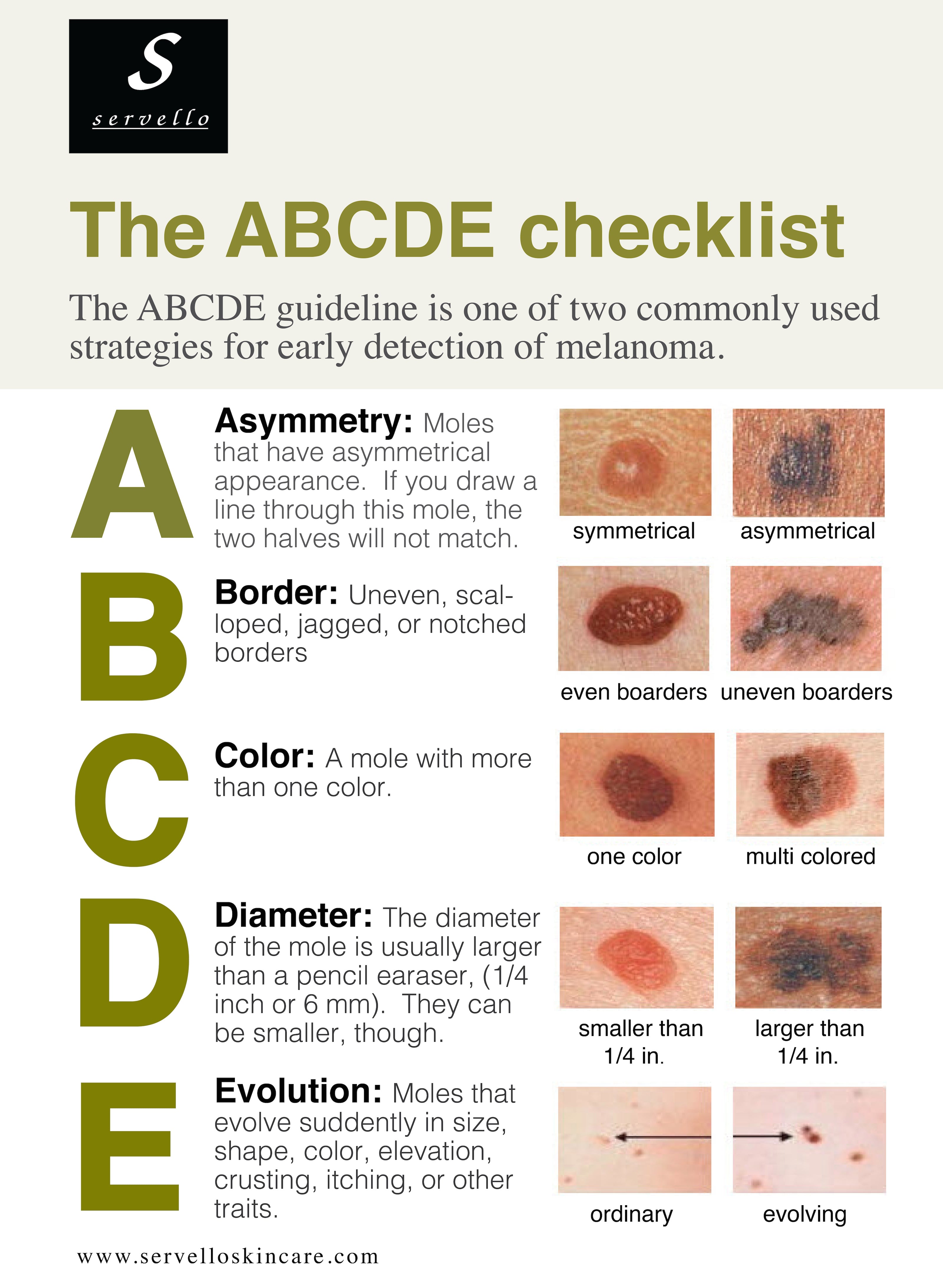 The ABCDE's of Skin Cancer